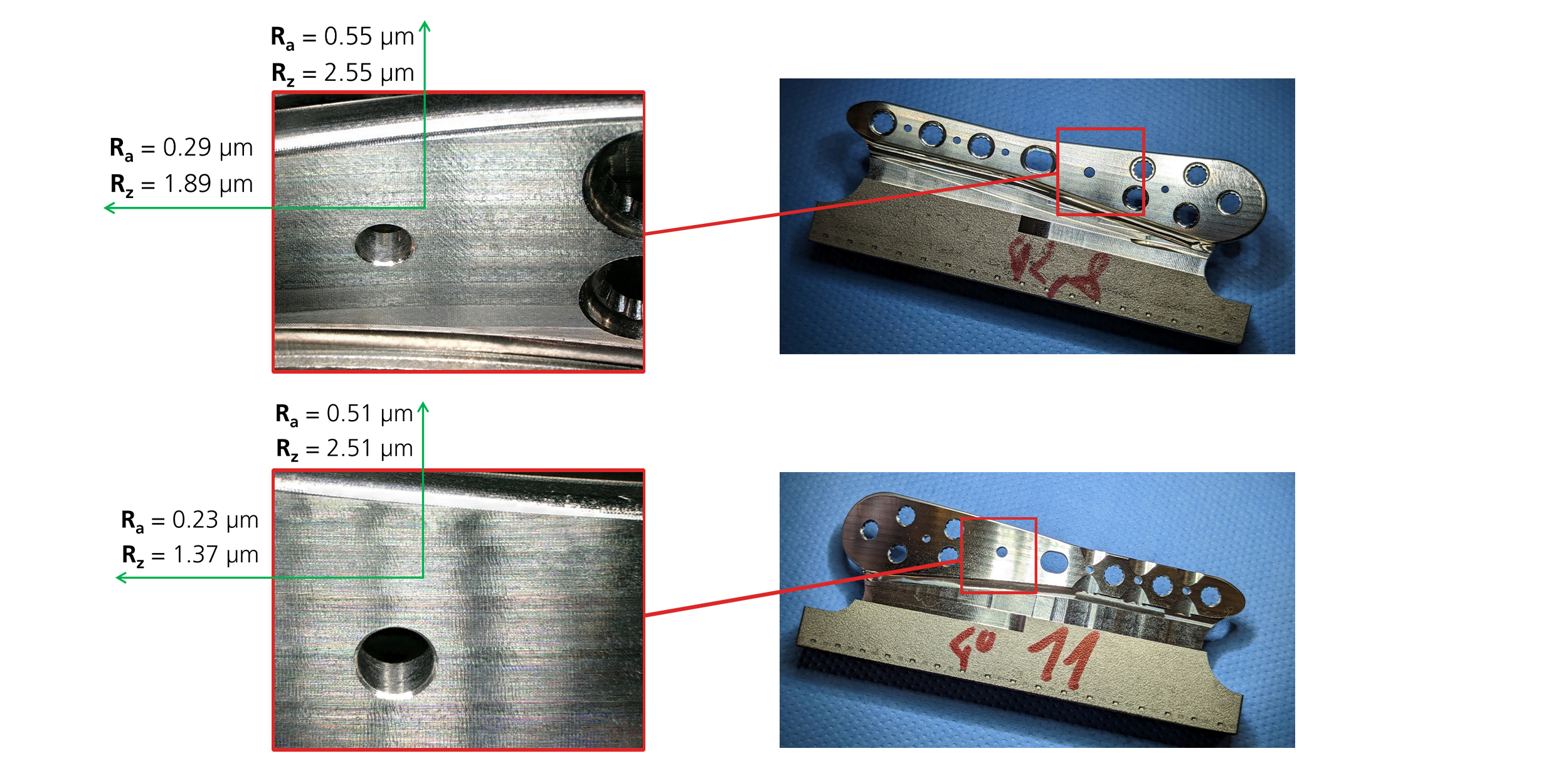 Tibial compression Plate surfaces